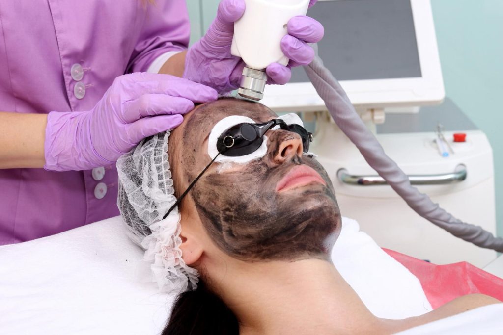 tehnologii laser cu carbon